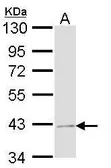 Anti-Jab1 antibody [N1C1] used in Western Blot (WB). GTX113927