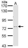 Anti-Calpain 10 antibody [N1C1] used in Western Blot (WB). GTX113929