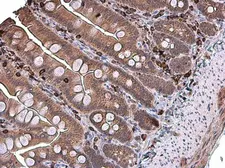 Anti-Coronin 1A antibody [N1N3] used in IHC (Paraffin sections) (IHC-P). GTX113931