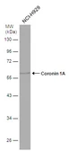 Anti-Coronin 1A antibody [N2C2], Internal used in Western Blot (WB). GTX113932