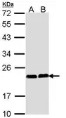 Anti-Calcium binding protein p22 antibody used in Western Blot (WB). GTX113936