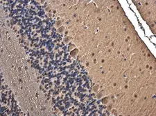 Anti-TRIM32 antibody used in IHC (Paraffin sections) (IHC-P). GTX113937