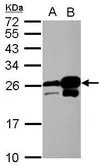 Anti-HP1 alpha antibody used in Western Blot (WB). GTX113944