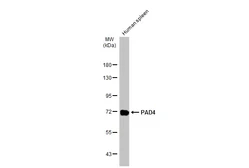 Anti-PAD4 antibody used in Western Blot (WB). GTX113945