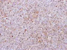 Anti-PAD4 antibody [N1N3] used in IHC (Paraffin sections) (IHC-P). GTX113946