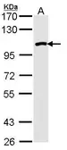 Anti-RAD54B antibody [N1N2], N-term used in Western Blot (WB). GTX113950