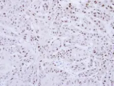Anti-RAD18 antibody [N1C1] used in IHC (Paraffin sections) (IHC-P). GTX113987