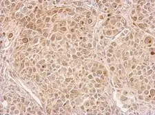 Anti-CIAPIN1 antibody used in IHC (Paraffin sections) (IHC-P). GTX113988