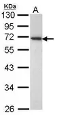 Anti-CD177 antibody [N3C3] used in Western Blot (WB). GTX113989