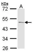 Anti-Prostatic Acid Phosphatase antibody [N3C3] used in Western Blot (WB). GTX114004
