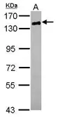 Anti-CD22 antibody [C2C3], C-term used in Western Blot (WB). GTX114015