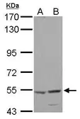 Anti-HARS antibody [N1C1] used in Western Blot (WB). GTX114032