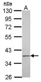 Anti-IGBP1 antibody [N3C3] used in Western Blot (WB). GTX114036