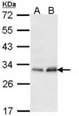 Anti-PMM2 antibody [N1C3] used in Western Blot (WB). GTX114049