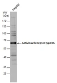 Anti-Activin Receptor Type IIA antibody [C1C3] used in Western Blot (WB). GTX114053