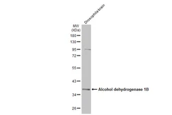Anti-Alcohol dehydrogenase 1B antibody [N2C3] used in Western Blot (WB). GTX114054