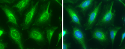 Anti-ATP6V1E1 antibody used in Immunocytochemistry/ Immunofluorescence (ICC/IF). GTX114056