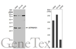Anti-ATP6V1E1 antibody used in Western Blot (WB). GTX114056