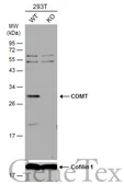 Anti-COMT antibody used in Western Blot (WB). GTX114062