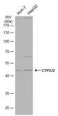 Anti-CYP2J2 antibody [N3C3] used in Western Blot (WB). GTX114064