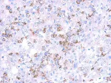 Anti-CYP27A1 antibody used in IHC (Paraffin sections) (IHC-P). GTX114065