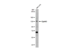 Anti-EphA3 antibody [N1N3] used in Western Blot (WB). GTX114067