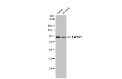 Anti-EWSR1 antibody used in Western Blot (WB). GTX114069