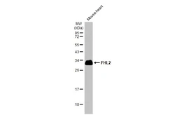 Anti-FHL2 antibody used in Western Blot (WB). GTX114072