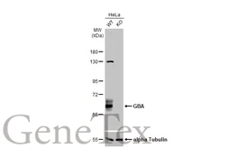 Anti-GBA antibody used in Western Blot (WB). GTX114073