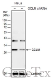 Anti-GCLM antibody used in Western Blot (WB). GTX114075