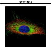 Anti-Gelsolin antibody used in Immunocytochemistry/ Immunofluorescence (ICC/IF). GTX114078