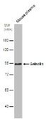 Anti-Gelsolin antibody used in Western Blot (WB). GTX114078