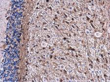Anti-Gelsolin antibody used in IHC (Paraffin sections) (IHC-P). GTX114078