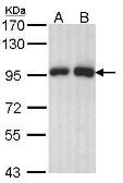 Anti-Gelsolin antibody used in Western Blot (WB). GTX114078