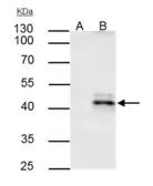 Anti-HLA-A antibody [N1C2] used in Immunoprecipitation (IP). GTX114080