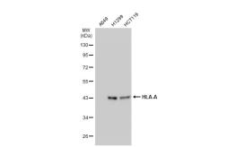 Anti-HLA-A antibody [N1C2] used in Western Blot (WB). GTX114080
