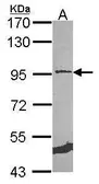 Anti-MCM5 antibody used in Western Blot (WB). GTX114090