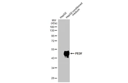 Anti-PEDF antibody [N1C2] used in Western Blot (WB). GTX114097