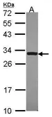 Anti-DcR3 antibody [N1C2] used in Western Blot (WB). GTX114109