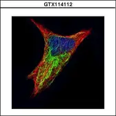 Anti-Cytokeratin 17 antibody used in Immunocytochemistry/ Immunofluorescence (ICC/IF). GTX114112