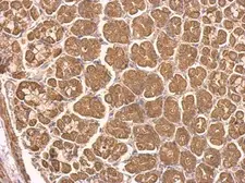 Anti-NDUFS8 antibody used in IHC (Paraffin sections) (IHC-P). GTX114119