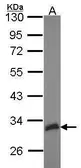 Anti-HEYL antibody [N1C1] used in Western Blot (WB). GTX114121