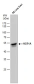 Anti-UGT1A antibody [C1C3] used in Western Blot (WB). GTX114128