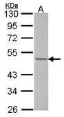 Anti-CUGBP1 antibody [N1C1-2] used in Western Blot (WB). GTX114129