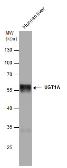 Anti-UGT1A antibody used in Western Blot (WB). GTX114131