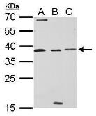 Anti-Livin antibody used in Western Blot (WB). GTX114132