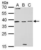 Anti-Livin antibody used in Western Blot (WB). GTX114132