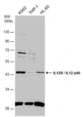 Anti-IL12B / IL12 p40 antibody used in Western Blot (WB). GTX114135
