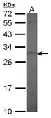 Anti-Prolactin antibody [N1C3] used in Western Blot (WB). GTX114138