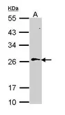 Anti-RAN antibody used in Western Blot (WB). GTX114139